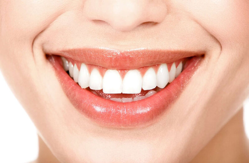 Giúp bạn tự tin với nụ cười tự nhiên  (Nguồn: Internet)