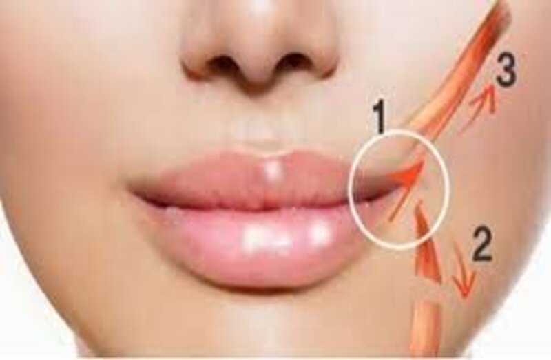 Quy trình cắt khoé miệng cười chuẩn y khoa  (Nguồn: Internet)