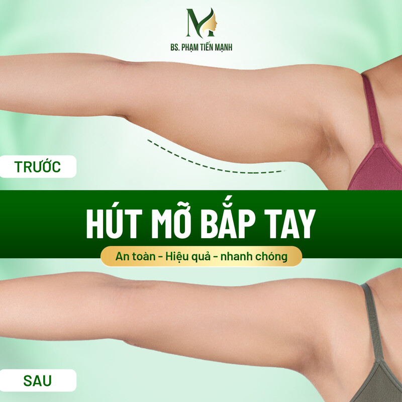 Hút mỡ bắp tay có nguy hiểm không?