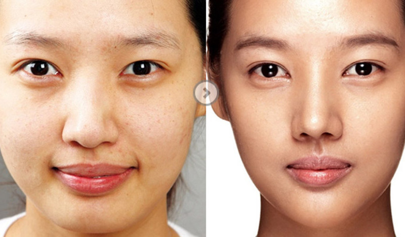 Nâng mũi đẹp tự nhiên: Bí quyết sở hữu dáng mũi hoàn hảo