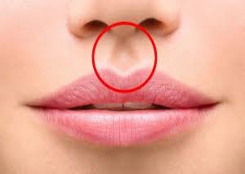 Hình dạng nhân trung như thế nào là đẹp? (Nguồn: Internet)