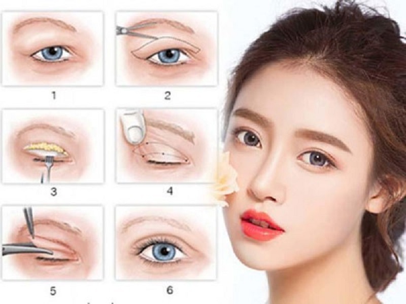 Kangnam - Địa chỉ tạo mắt 2 mí Hà Nội tự nhiên (Nguồn:Internet)