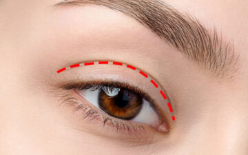 Top 7 địa chỉ bấm mí đa điểm Hà Nội uy tín