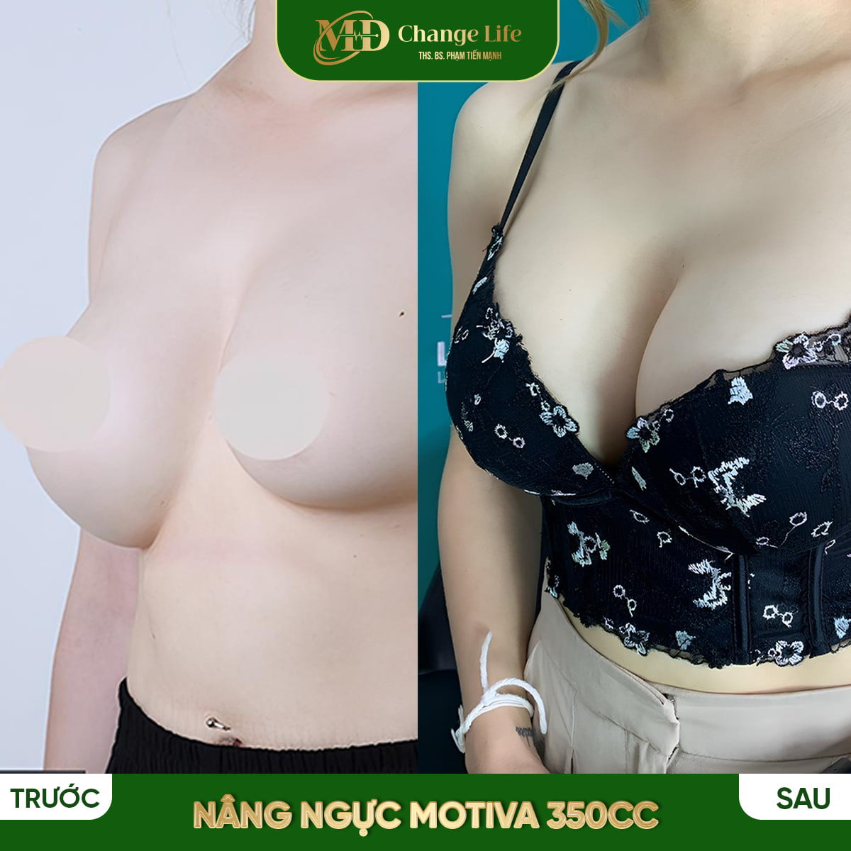 Trang chủ